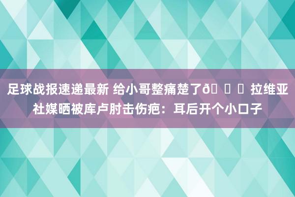 足球战报速递最新 给小哥整痛楚了😅拉维亚社媒晒被库卢肘击伤疤：耳后开个小口子